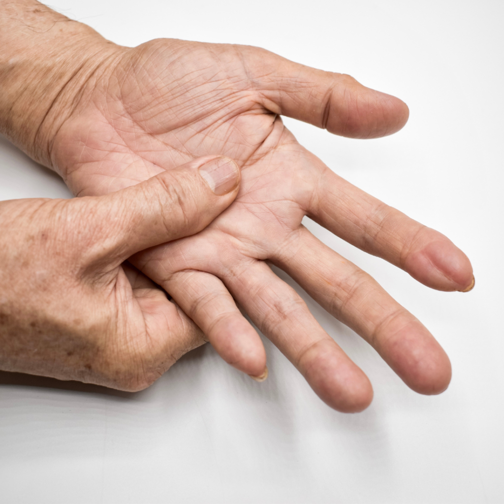 preensão palmar